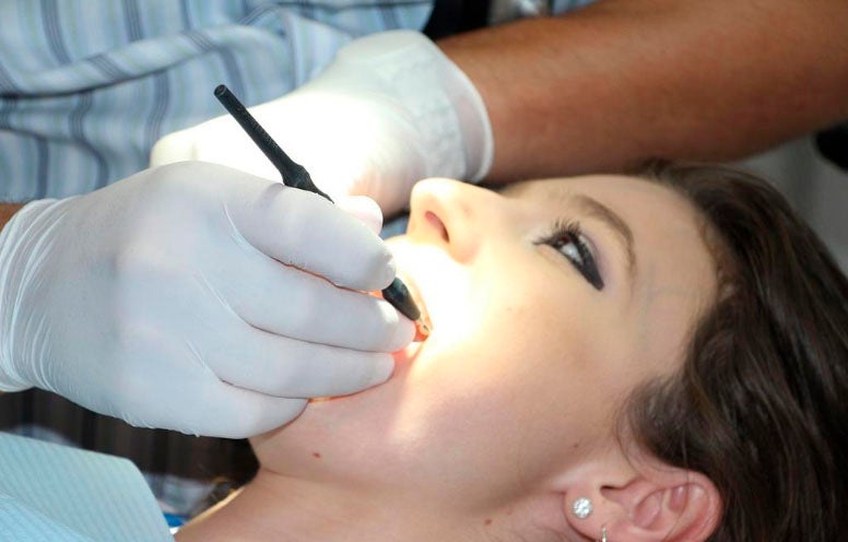 eliminar sarro dientes